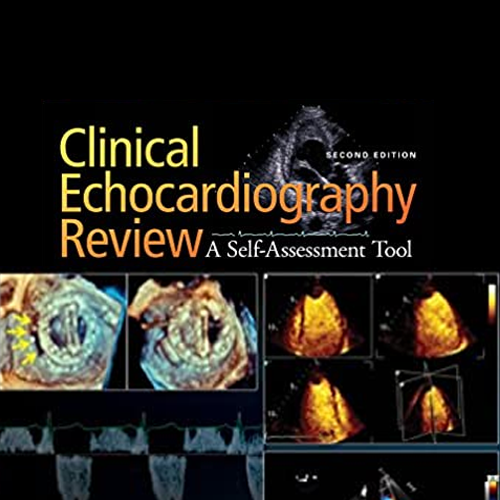Clinical Echocardiography Review 2e